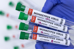 Monkeypox test sample.