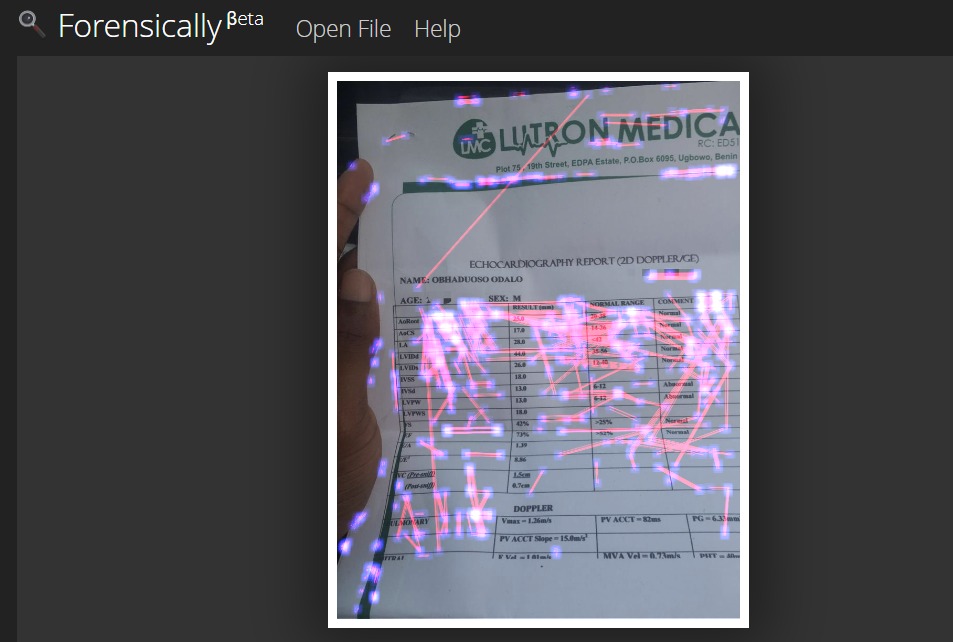 A screenshot of the forensic analysis of Odalo’s alleged echocardiography report carried out on Oct. 13, 2023.