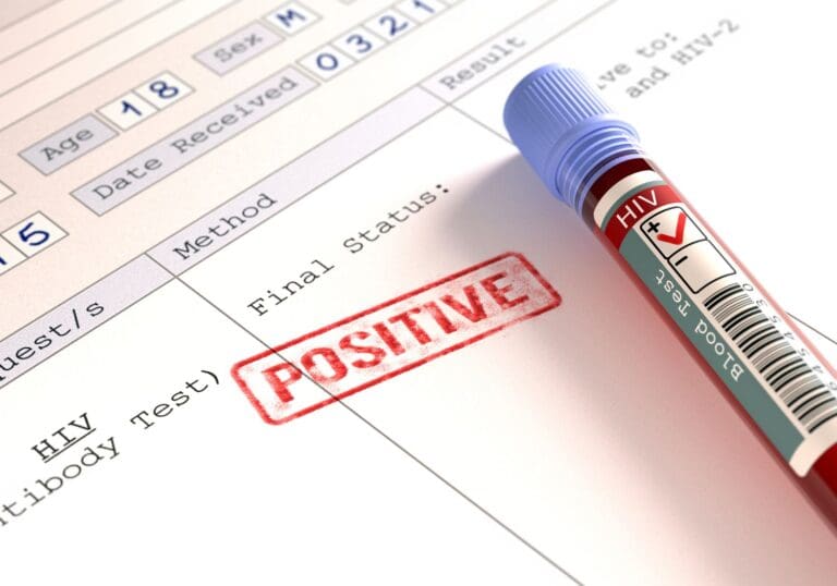 Are HIV+ persons barred from migrating to Canada, Australia or UAE?