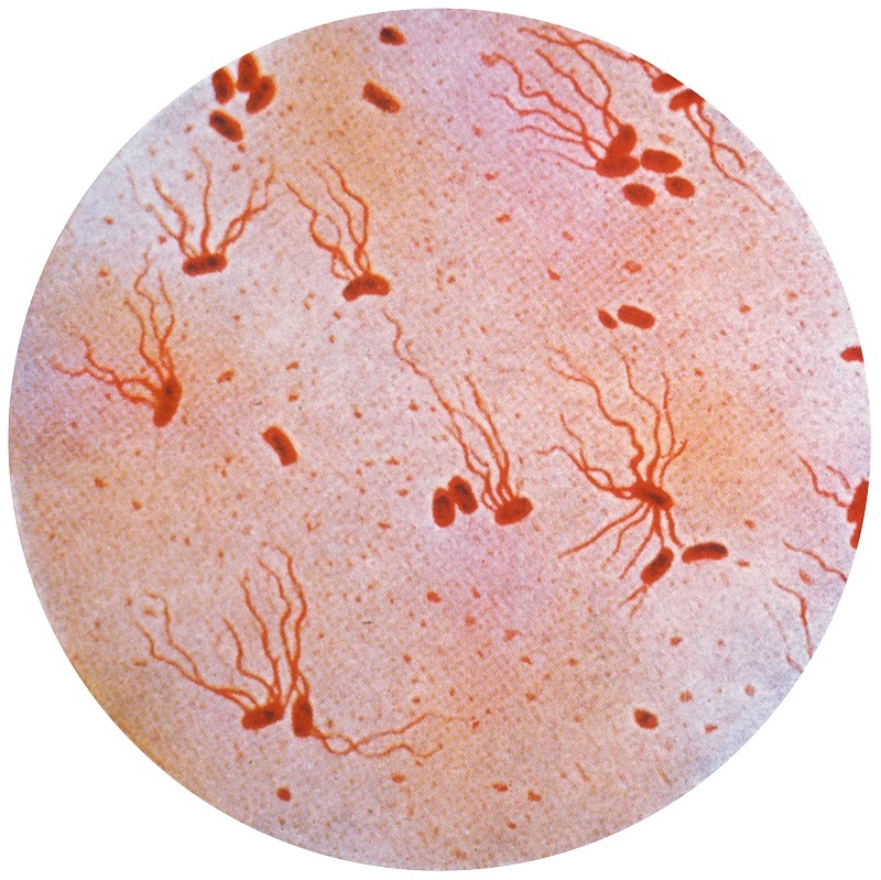 Photomicrograph of Salmonella typhi also known as Typhoid fever. PHOTO CREDITS: Britannica.com.